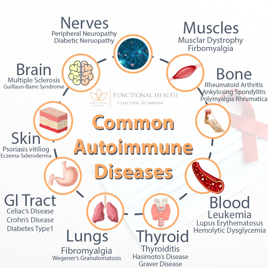 Control autoimmune disease – FHC-SAWSAN